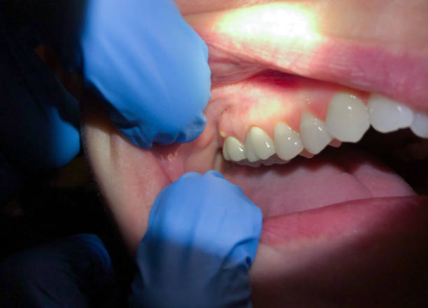 Best Mobile Emergency Dentist in Lapel, IN